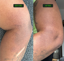 Load image into Gallery viewer, Before and after comparison of arm skin using Petrichor Omega Body Oil, showing improved texture and tone.