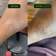Load image into Gallery viewer, Before and after image showing skin improvement in 3 weeks with Coriander Seed Omega Body Oil.