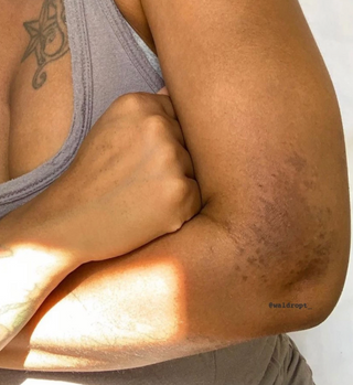 My TERRA-TORY Fresh Carrot Soap & Eczema Management