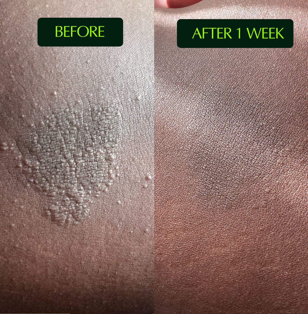 Chafinga Rash Small acts of wellness renders big healing. – TERRA-TORY